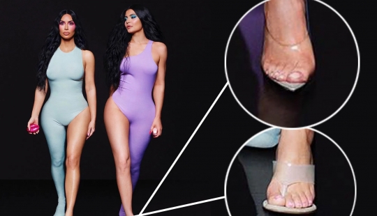 Vista inferior: Adivina qué celebridades tienen dedos de los pies en las fotos