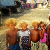 Why are dark-skinned blondes born in the Solomon Islands