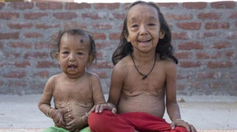 Why do brother and sister from India look like little old men