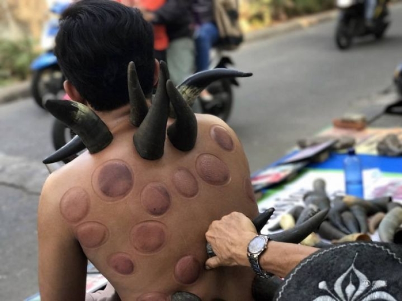 Why do street healers put horns on patients' backs in Indonesia