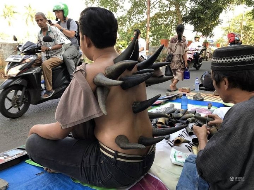 Why do street healers put horns on patients' backs in Indonesia