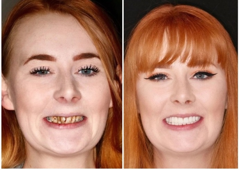 With a smile for life: how a girl transformed with terrible teeth