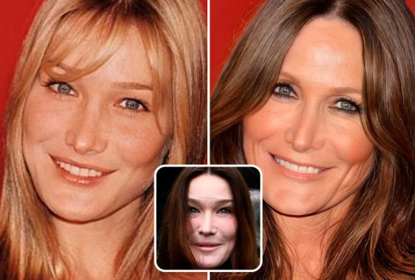 With the help of artificial intelligence, we learn how to look at these celebrities without plastic surgery