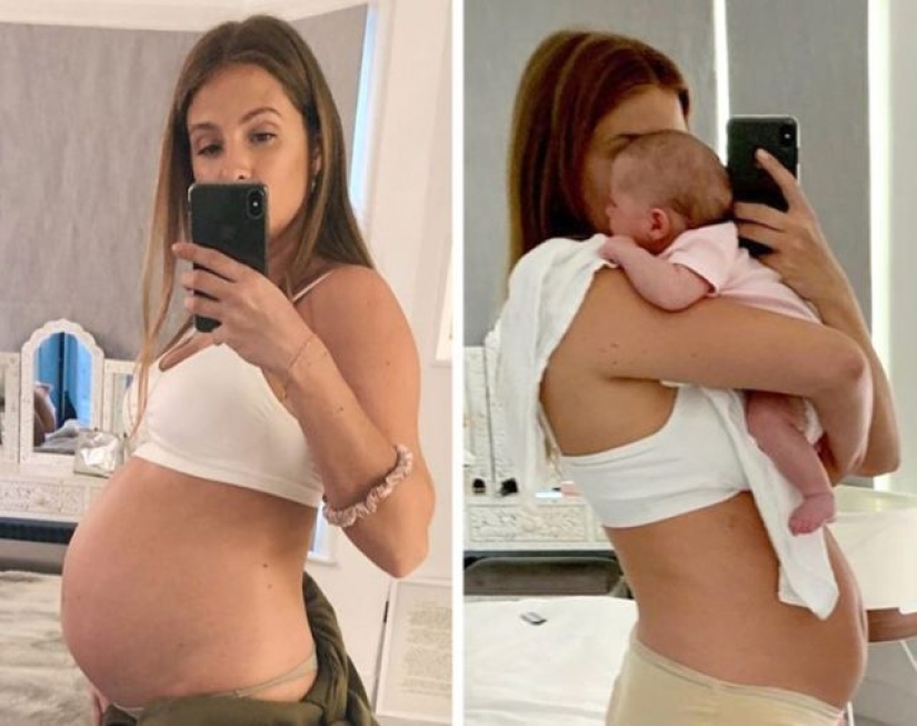 10 Celeb Moms Who Proudly Shared Their Postpartum Body With The World