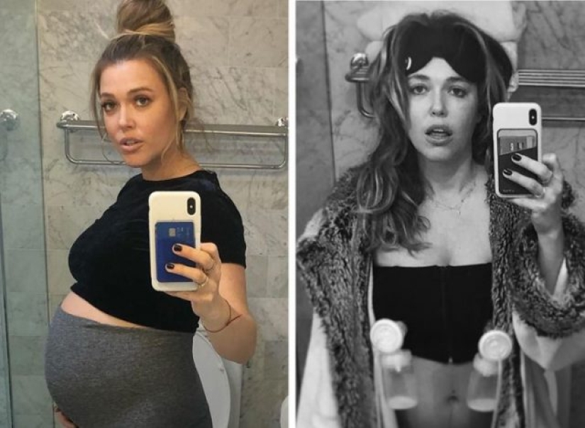 10 Celeb Moms Who Proudly Shared Their Postpartum Body With The World