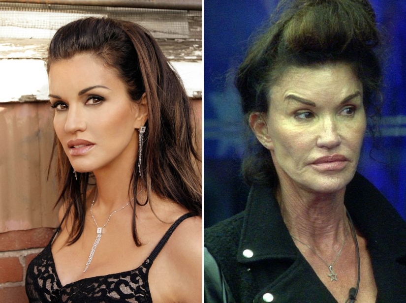 10 celebrities who strongly regretted plastic surgery