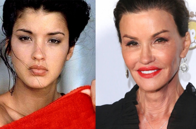 10 celebrities who strongly regretted plastic surgery