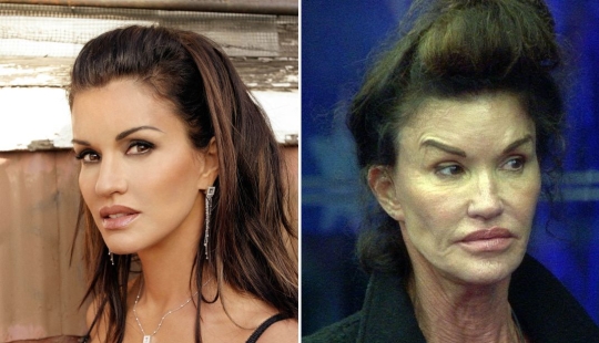 10 celebrities who strongly regretted plastic surgery