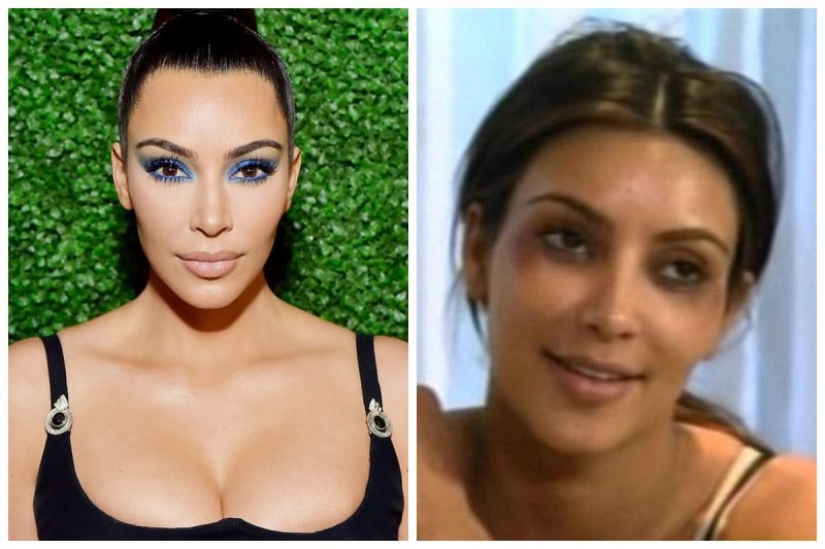10 celebrities who strongly regretted plastic surgery