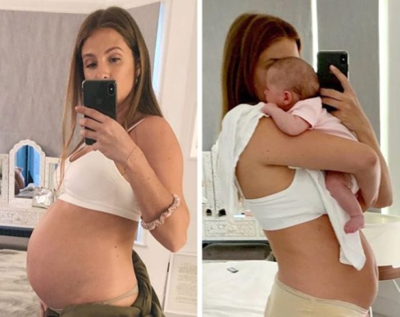 10 mamás famosas que orgullosamente compartieron su cuerpo posparto con el mundo