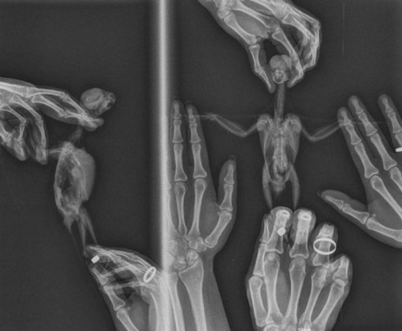 14 cosas que la naturaleza no puede mostrar, pero una radiografía puede mostrar