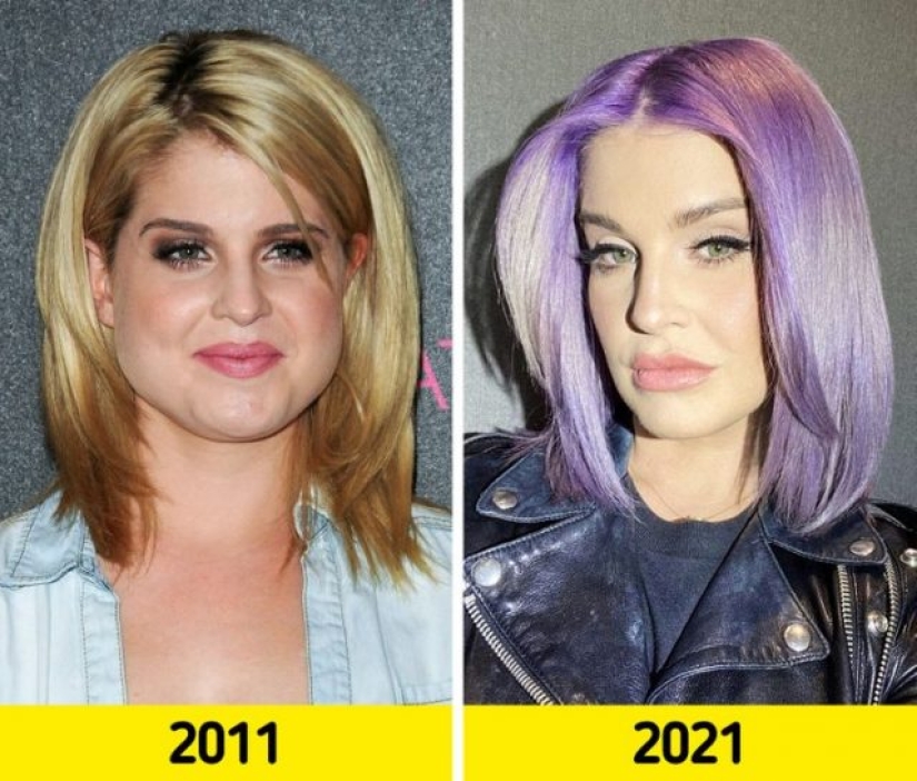 16 celebrities who have changed beyond recognition over the past decade