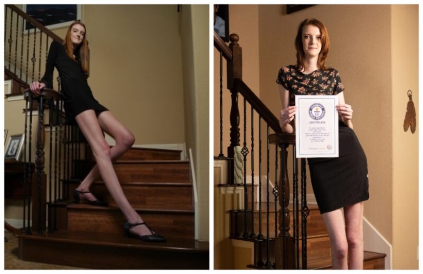 19-year—old Macy Karrin is the owner of the longest legs in the world
