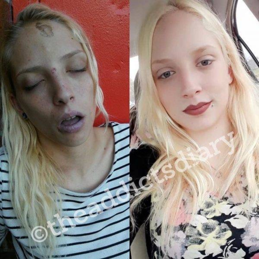 20 fotos de personas "antes y después" de cómo lograron hacer frente a la adicción