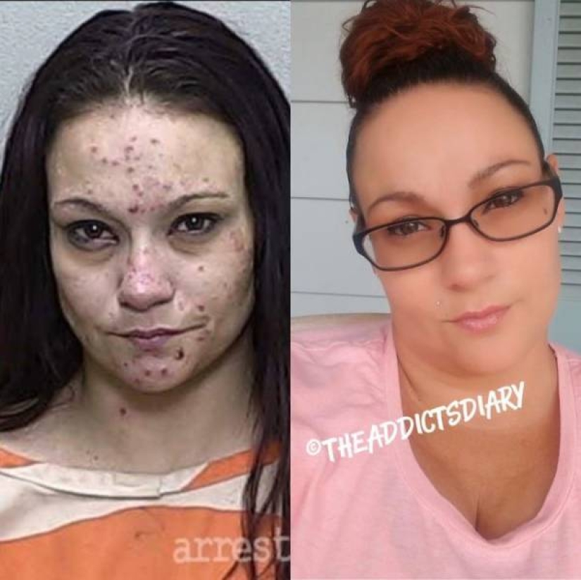 20 fotos de personas "antes y después" de cómo lograron hacer frente a la adicción