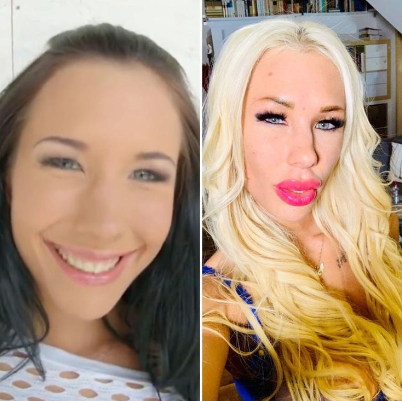 30 people who got carried away with plastic surgery and forgot to stop