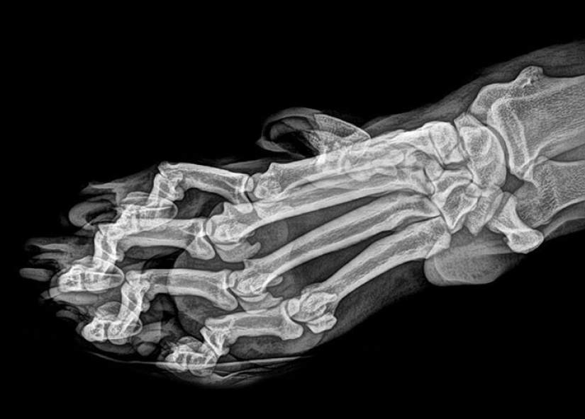 35 x-ray images that reveal the world from an unexpected quarter