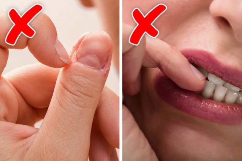 5 cosas que tu morderse las uñas revela sobre ti