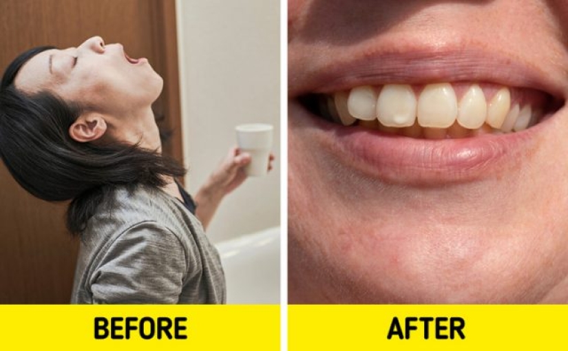 6 razones por las que tus dientes pueden estar manchados