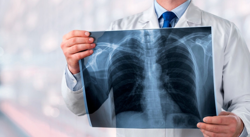 6 signs of "quiet" pneumonia that cannot be missed