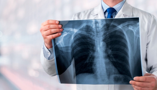6 signs of "quiet" pneumonia that cannot be missed