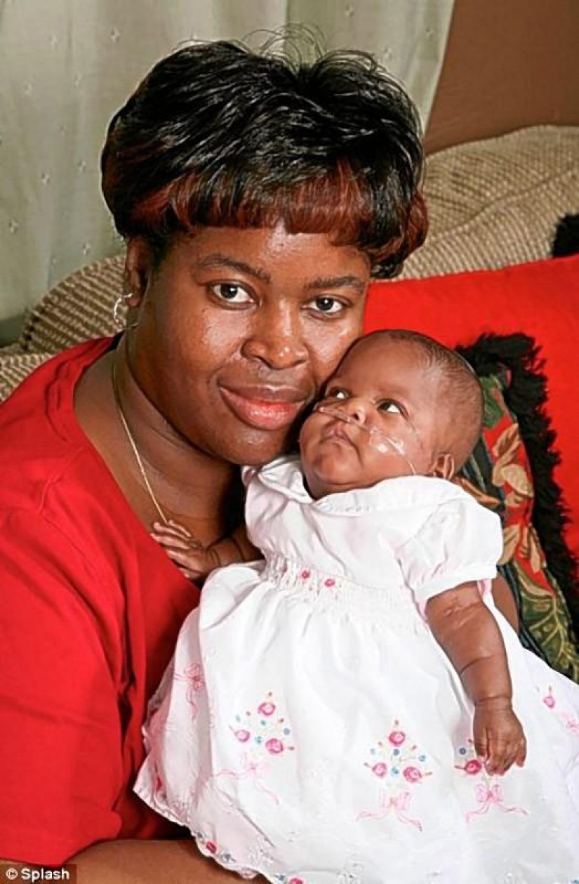 7 incredible stories of survival of babies