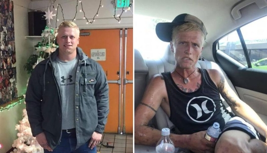 7 months of heroin addiction and its terrible consequences: mother showed shocking photos of her son