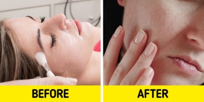 7 productos para el cuidado de la piel que pueden dañar tu piel