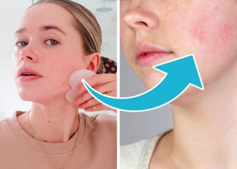7 skin care products that can harm your skin