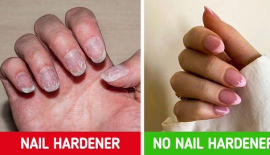 7 ways to make your nails stronger and longer