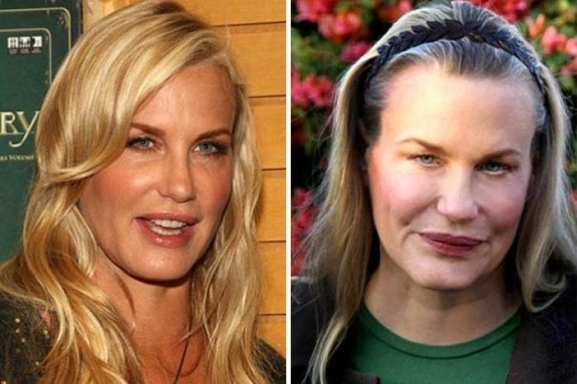 8 movie stars who lost their careers after plastic surgery