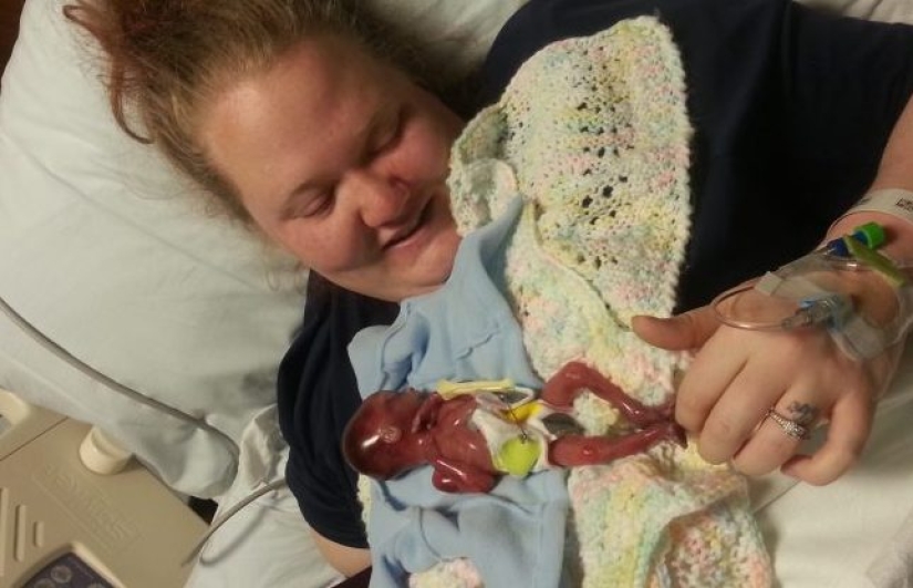 A child or a biomaterial? An American woman has published a photo of her stillborn son