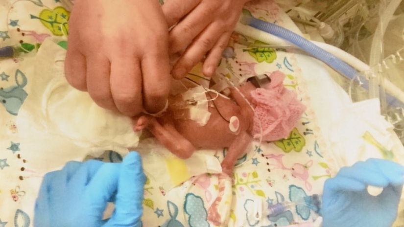 A child or a biomaterial? An American woman has published a photo of her stillborn son