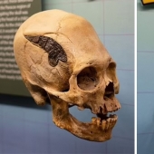 A human skull bonded with metal 2000 years ago amazed scientists