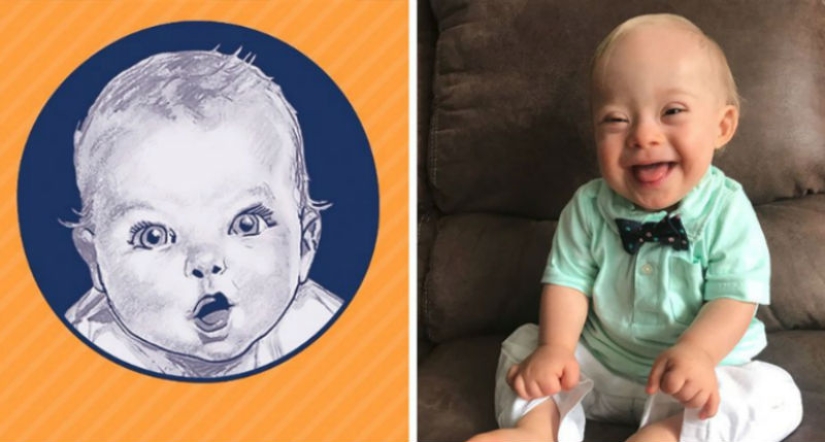 A kid with Down syndrome conquered Gerber with his smile and became the face of a baby food company