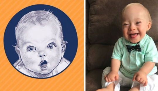 A kid with Down syndrome conquered Gerber with his smile and became the face of a baby food company