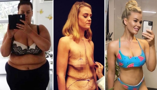A new body is a new life: the girl has changed beyond recognition, having lost 90 kg