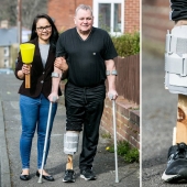 A new leg with her own hands: a woman made a prosthesis for her husband from improvised materials