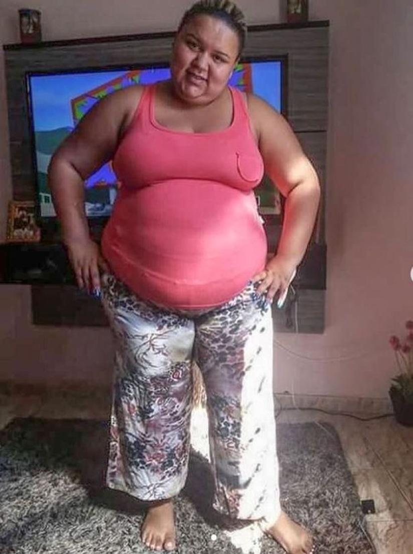 A young mother from Brazil lost 70 kg in two years and became a successful model