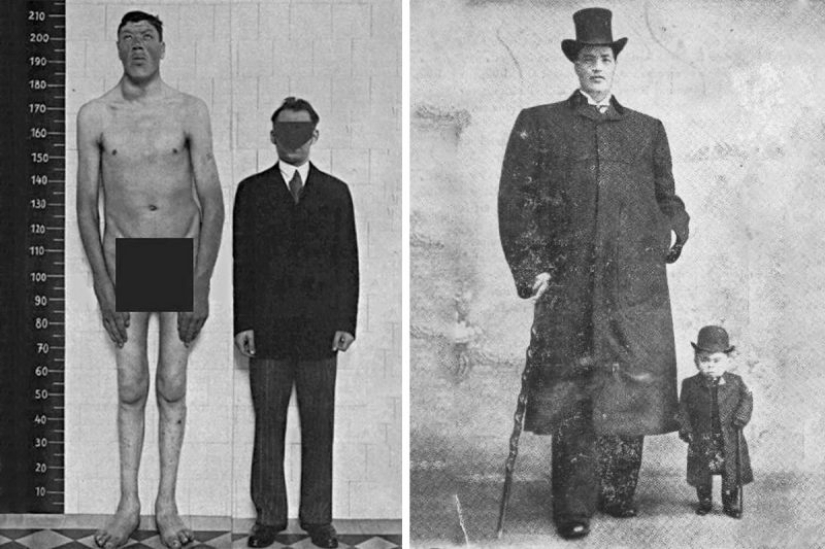 Adam Rainer: the story of an unfortunate guy who managed to be a dwarf and a giant