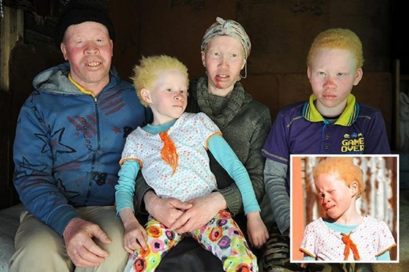 African albinos do not hide their fears