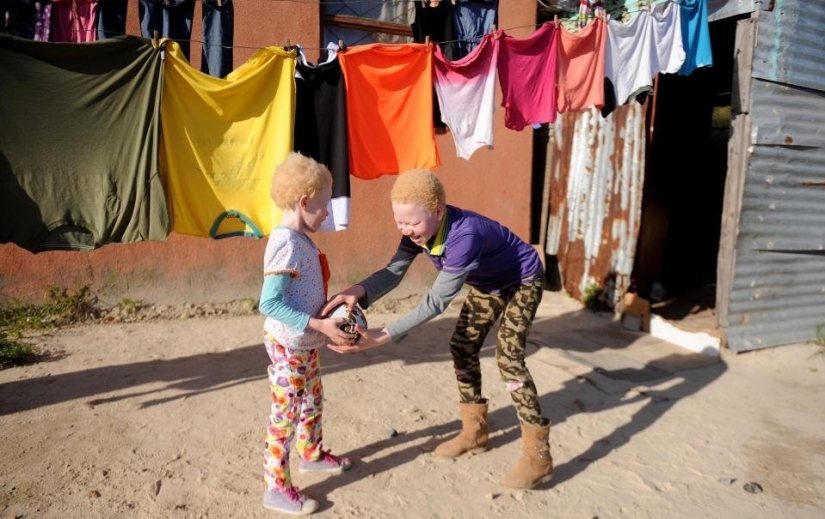 African albinos do not hide their fears