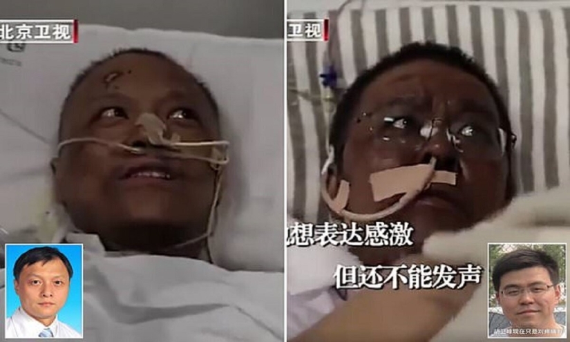 After treatment for coronavirus, doctors from Wuhan became dark-skinned