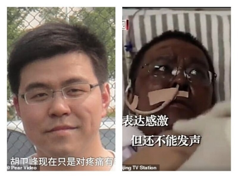 After treatment for coronavirus, doctors from Wuhan became dark-skinned