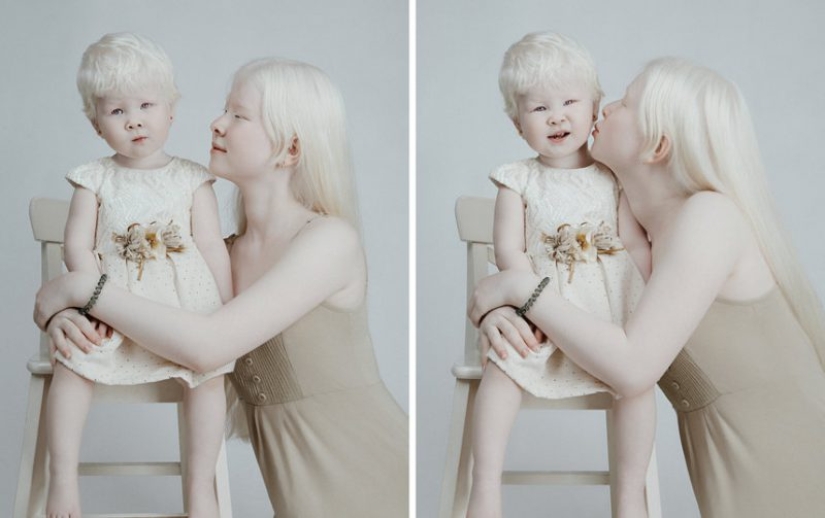 Albino sisters from Kazakhstan conquer the modeling world