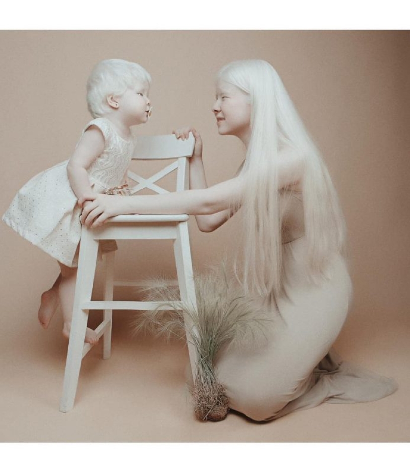 Albino sisters from Kazakhstan conquer the modeling world