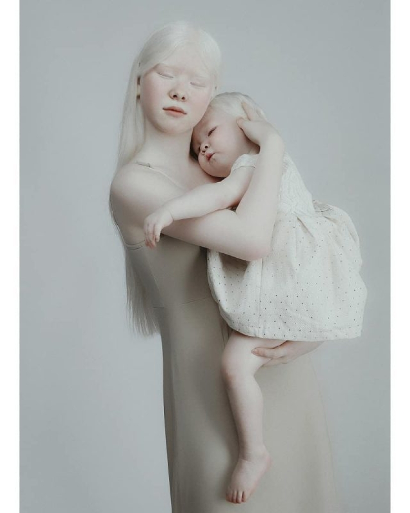 Albino sisters from Kazakhstan conquer the modeling world