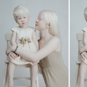 Albino sisters from Kazakhstan conquer the modeling world