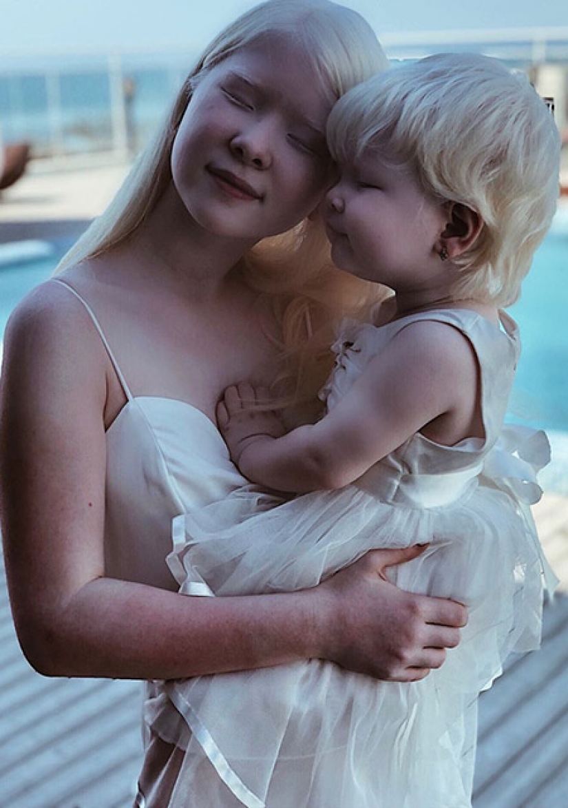 Albino sisters from Kazakhstan conquer the modeling world