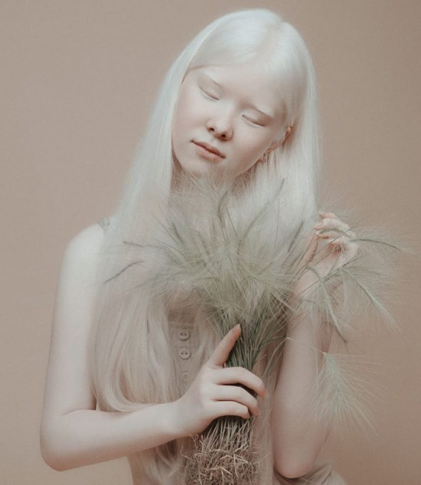 Albino sisters from Kazakhstan conquer the modeling world